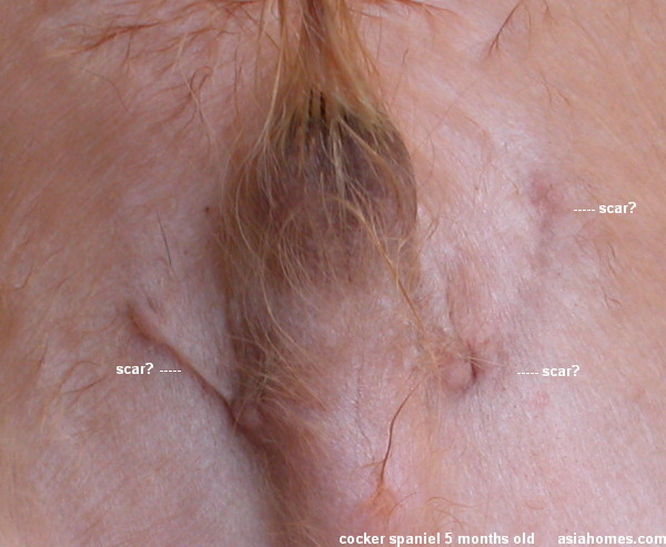 Scars On Penis 91