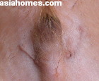 Singapore cocker spaniel with "scars" near penis