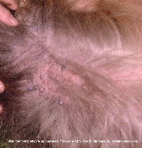 Singapore. 15-year-old Silkie Cross.  Grey skin tumours.  Asiahomes.com
