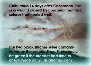 Caesarean wound healed 14 days after surgery.