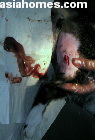 Necrotising tissues in the leg abscess.  A smell which was very foul
