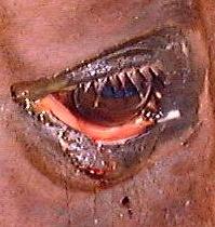 Racehorse. Left eye flushed with clean water.